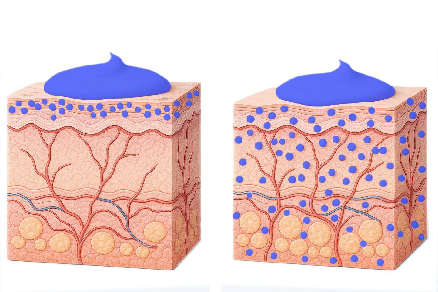 Diamondstick Hyaluron Filler