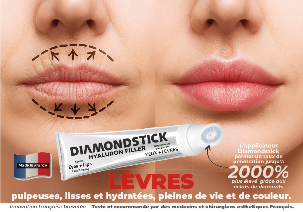 Diamondstick Hyaluron Filler